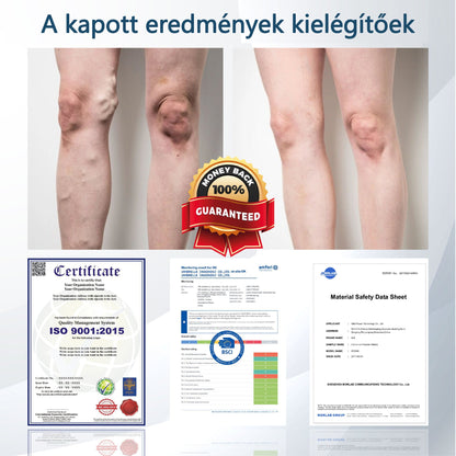 💧💧💧ATTDX® Növényi ödéma enyhítő krém nigellával