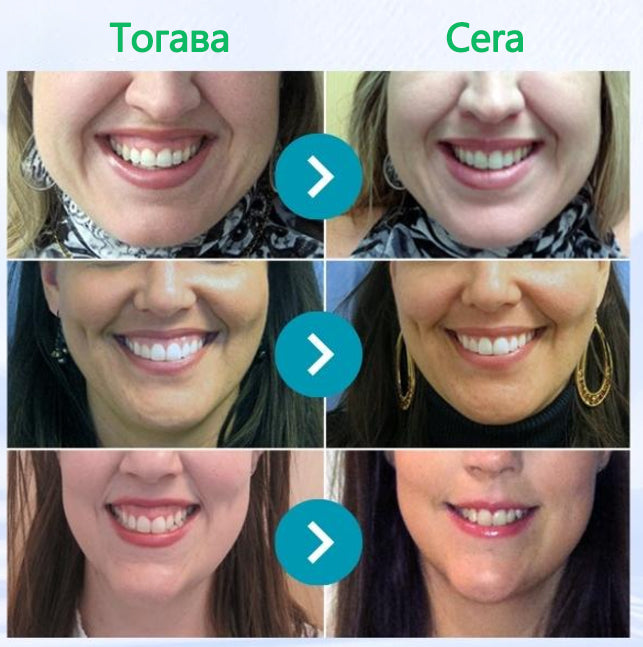 Furzero® 🦷 Focussmile Прах за третиране с пчелна отрова за перорално приложение 🌿