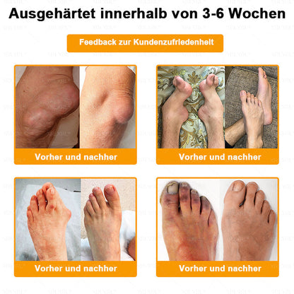 XRLXRL® Bienengift Schmerzstillende Knochenheilungscreme 👑👑👑LETZTER TAG 80 % RABATT