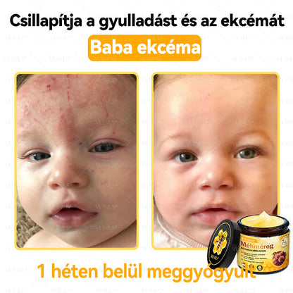 💪💪💪VLSVLS® Méhméreg Bőrhelyreállító Krém (👨‍⚕‍CE jóváhagyott)👍✅