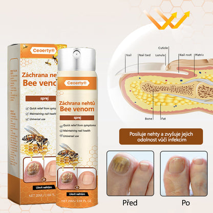 【Oficiální vlajkový obchod】Ceoerty® NailRescue Včelí jed ve spreji