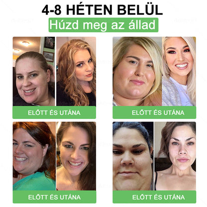 🍀 Klinikai kutatásokkal igazolt | A BuildLeaf® Berberine GLP-1 Pro Súlycsökkentő Szájon át szedhető oldat segíthet a makacs súlytöbblet, anyagcsere- és energiaproblémák kezelésében, támogatva a jobb közérzetet és vitalitást