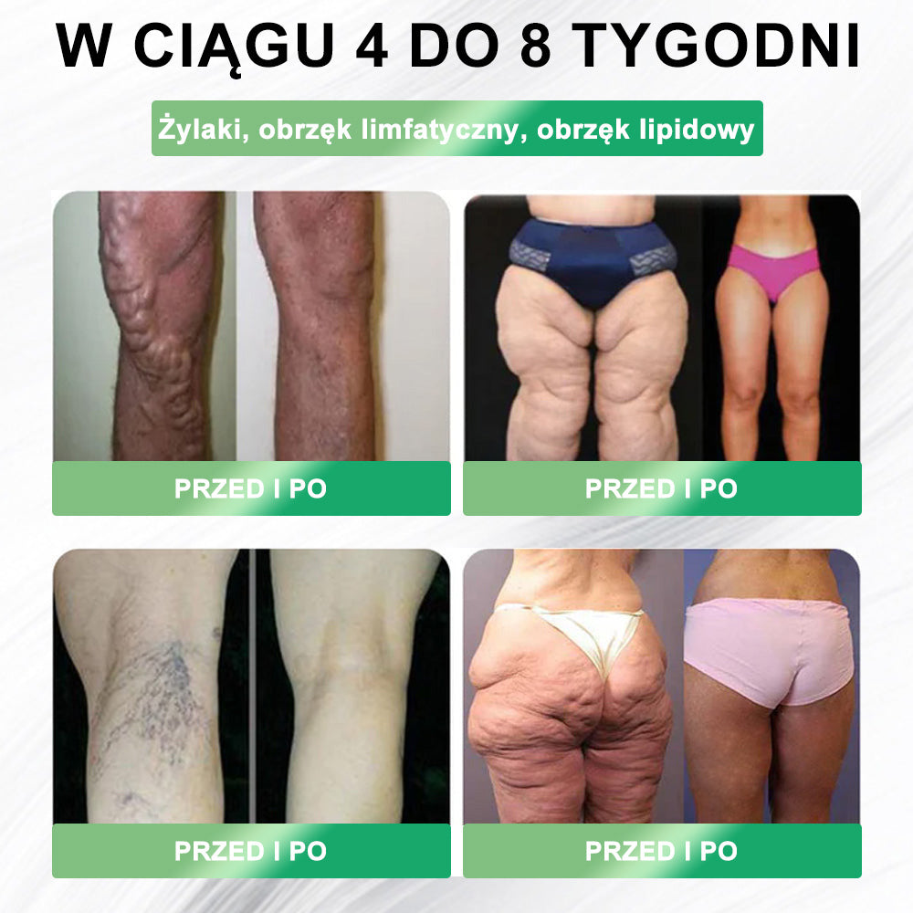 ✨✨NAZIAP® GLP-1 8 w 1 Fit & Vital roztwór doustny – Raz dziennie, widoczne zmiany w ciągu 7 dni / W przypadku otyłości, zdrowia serca i układu krążenia, cukrzycy, bezdechu sennego, zdrowia jelit, problemów ze stawami i wielu innych