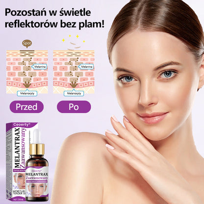✨✨Ceoerty® MelantraX Zaawansowana esencja przeciw przebarwieniom