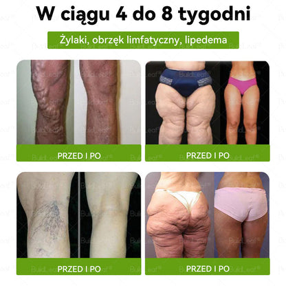 💕Wyprodukowano i wysłano z Polski💕 BuildLeaf® Tyrzepatyd GLP-1 Krople odchudzające i wspomagające zdrowie🔥🔥 OSTATNI DZIEŃ – SKORZYSTAJ Z 80% ZNIŻKI!