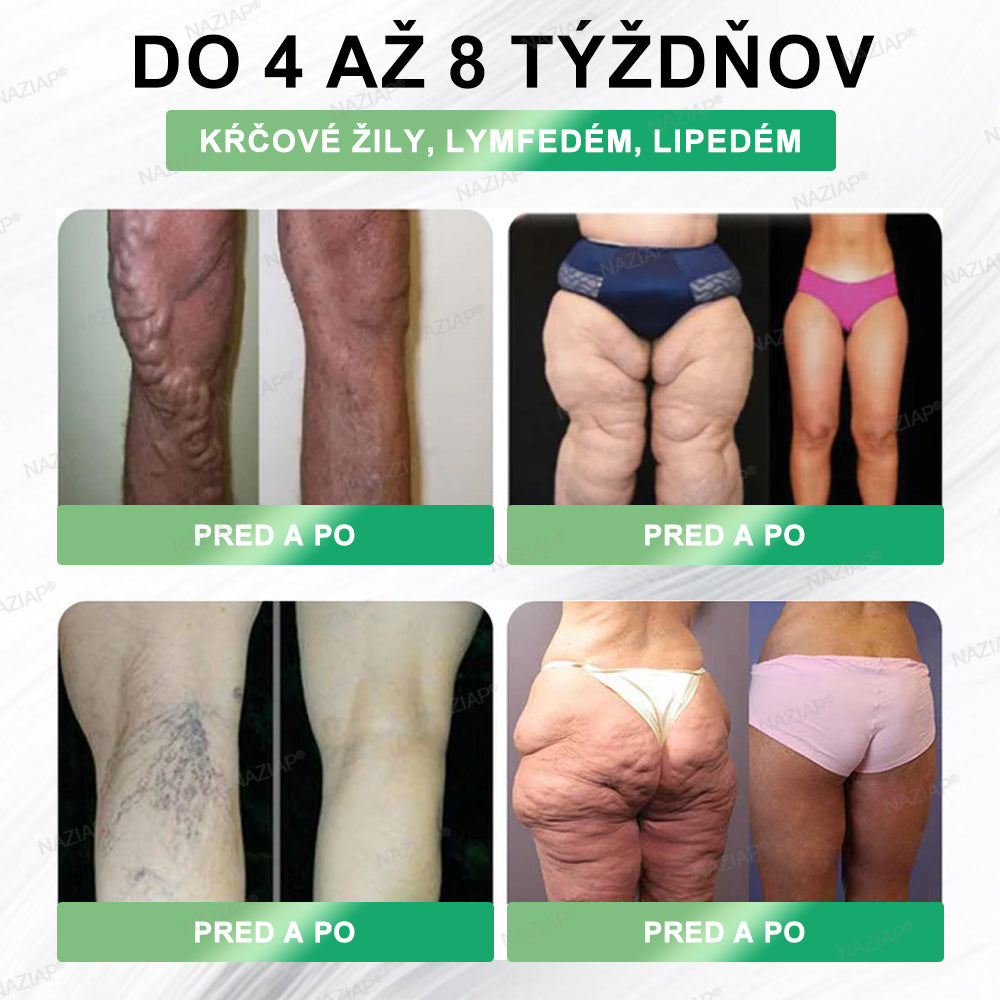 🫧🫧𝑵𝑨𝒁𝑰𝑨𝑷® 𝑮𝑳𝑷-1 8-𝒗-1 𝑭𝒊𝒕 & 𝑽𝒊𝒕𝒂𝒍 𝑷𝒆𝒓𝒐𝒓á𝒍𝒏𝒚 𝑹𝒐𝒛𝒕𝒐𝒌 ✅ (𝑳𝒆𝒏 𝒓𝒂𝒛 𝒅𝒆𝒏𝒏𝒆, 𝒗𝒊𝒅𝒊𝒕𝒆ľ𝒏é 𝒛𝒎𝒆𝒏𝒚 𝒖ž 𝒛𝒂 7 𝒅𝒏í) 𝑷𝒓𝒆 𝒐𝒃𝒆𝒛𝒊𝒕𝒖, 𝒌𝒂𝒓𝒅𝒊𝒐𝒗𝒂𝒔𝒌𝒖𝒍á𝒓𝒏𝒆 𝒐𝒄𝒉𝒐𝒓𝒆𝒏𝒊𝒂, 𝒄𝒖𝒌𝒓𝒐𝒗𝒌𝒖, 𝒔𝒑á𝒏𝒌𝒐𝒗é 𝒂𝒑𝒏𝒐𝒆, 𝒛𝒅𝒓𝒂𝒗𝒊𝒆 č𝒓𝒊𝒆𝒗, 𝒑𝒓𝒐𝒃𝒍é𝒎𝒚 𝒔 𝒌ĺ𝒃𝒎𝒊 𝒂 ď𝒂𝒍š𝒊𝒆