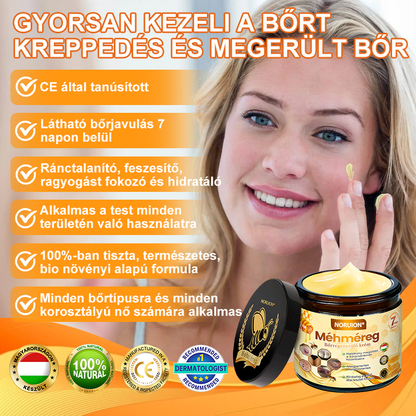 𝑴𝒂𝒈𝒚𝒂𝒓𝒐𝒓𝒔𝒛á𝒈𝒓ó𝒍 𝒌é𝒔𝒛ü𝒍𝒕 é𝒔 𝒔𝒛á𝒍𝒍í𝒕𝒐𝒕𝒕🐝🌸𝑵𝑶𝑹𝑼𝑰𝑶𝑵® 𝑴é𝒉𝒎é𝒓𝒆𝒈 𝑩ő𝒓𝒇𝒆𝒍ú𝒋í𝒕ó 𝑲𝒓é𝒎 🔥 𝑼𝑻𝑶𝑳𝑺Ó 𝑵𝑨𝑷 – 80% 𝑲𝑬𝑫𝑽𝑬𝒁𝑴É𝑵𝒀🔥