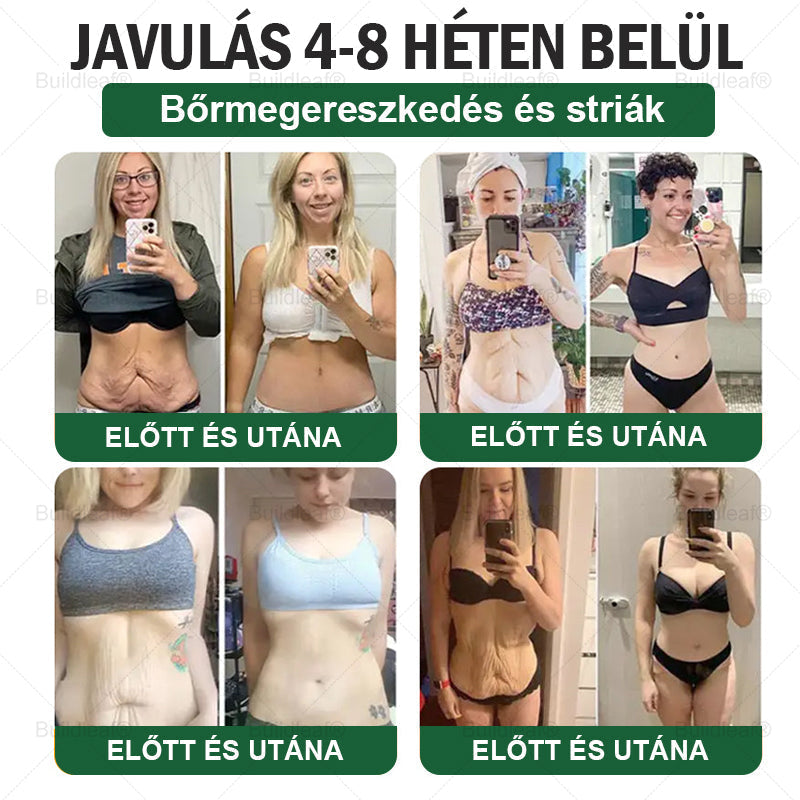 ✈️BuildLeaf® GLP-1 6 az 1-ben egészségügyi oldat szájon át szedhető folyadék ✅ Elhízás, szív- és érrendszeri egészség, cukorbetegség, alvási apnoe, bélrendszeri egészség, ízületi problémák és egyebek esetén