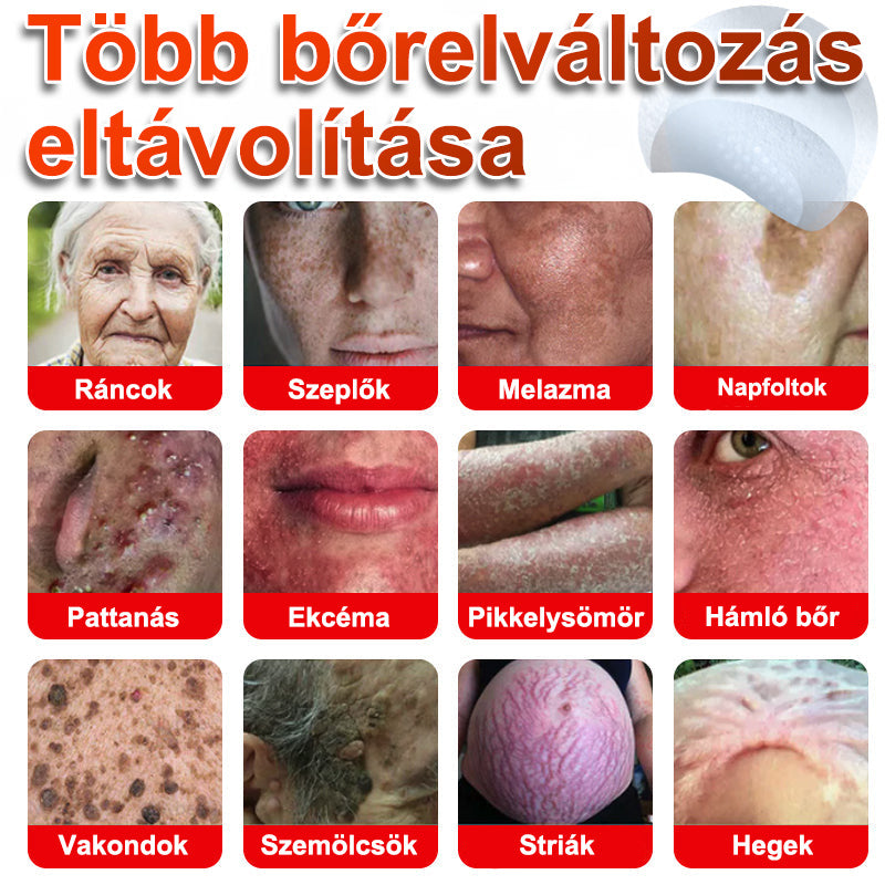 Voilaist® Mikro-tűs botanikai bőrnövedék-eltávolító ✅✅Készült Magyarországon