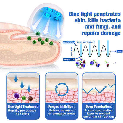 (🔥LIMITED DISCOUNT 70% - UTOLSÓ NAP🔥)Furzero ™ Lézeres körömgomba eltávolító készülék🔥