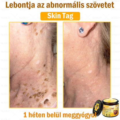 💪💪💪VLSVLS® Méhméreg Bőrhelyreállító Krém (👨‍⚕‍CE jóváhagyott)👍✅