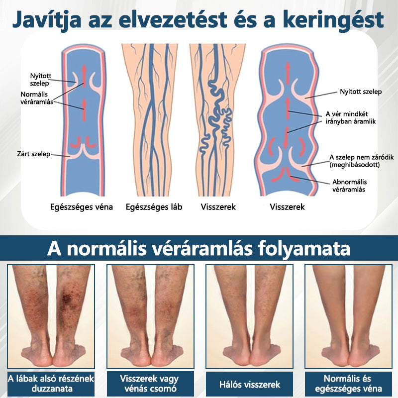 💧💧💧ATTDX® Növényi ödéma enyhítő krém nigellával