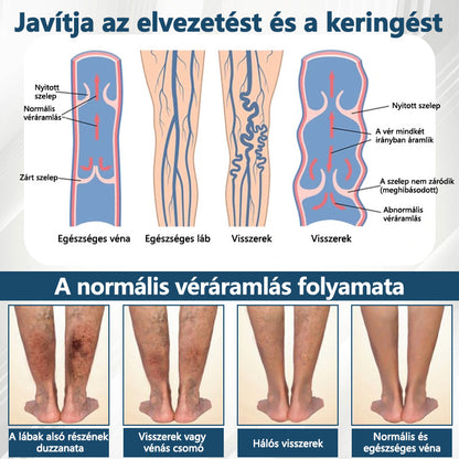 💧💧💧ATTDX® Növényi ödéma enyhítő krém nigellával