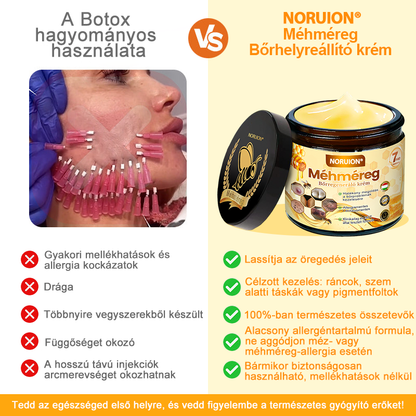 𝑴𝒂𝒈𝒚𝒂𝒓𝒐𝒓𝒔𝒛á𝒈𝒓ó𝒍 𝒌é𝒔𝒛ü𝒍𝒕 é𝒔 𝒔𝒛á𝒍𝒍í𝒕𝒐𝒕𝒕🐝🌸𝑵𝑶𝑹𝑼𝑰𝑶𝑵® 𝑴é𝒉𝒎é𝒓𝒆𝒈 𝑩ő𝒓𝒇𝒆𝒍ú𝒋í𝒕ó 𝑲𝒓é𝒎 🔥 𝑼𝑻𝑶𝑳𝑺Ó 𝑵𝑨𝑷 – 80% 𝑲𝑬𝑫𝑽𝑬𝒁𝑴É𝑵𝒀🔥