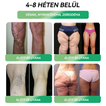 Semmelweis Egyetemi Kórház Ajánlásai |hivatalos áruház |💗💗 𝐒𝐓𝐃𝐄𝐈® 𝐆𝐋𝐏-𝟏 𝐅𝐨𝐠𝐲á𝐬 𝐒𝐳á𝐣𝐨𝐧 á𝐭 𝐚𝐥𝐤𝐚𝐥𝐦𝐚𝐳𝐡𝐚𝐭ó 𝐨𝐥𝐝𝐚𝐭 - 👨‍⚕️ Elhízás, szív- és érrendszeri betegségek, cukorbetegség, alvási apnoe, ízületi problémák és egyebek