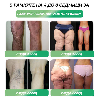 ✅ Препоръчано от над 100 000 души| официален магазин | 𝑆𝑇𝐷𝐸𝐼® 👩‍⚕️👩‍⚕️ 𝐺𝐿𝑃-1 Отслабване Орален разтвор - Затлъстяване, сърдечно-съдови заболявания, диабет, сънна апнея, проблеми със ставите и други