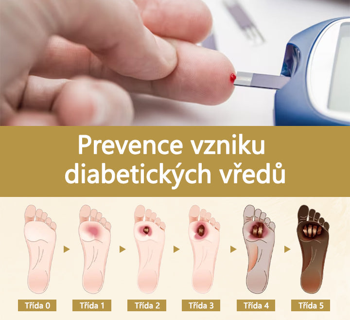 【Oficiální značkový obchod】Timilk® Sprej na hojení diabetické nohy - s obsahem včelího jedu