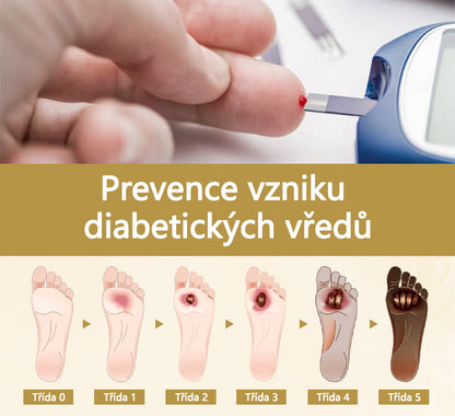 【Oficiální značkový obchod】Timilk® Sprej na hojení diabetické nohy - s obsahem včelího jedu