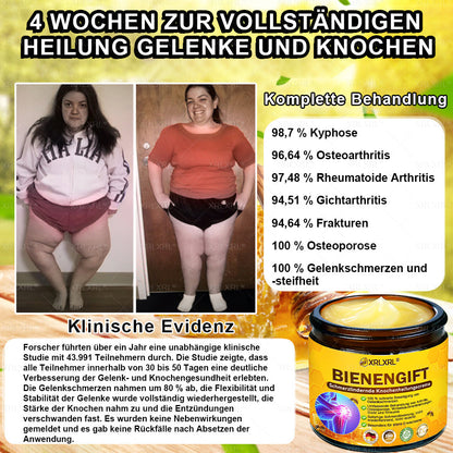 XRLXRL® Bienengift Schmerzstillende Knochenheilungscreme 👑👑👑LETZTER TAG 80 % RABATT