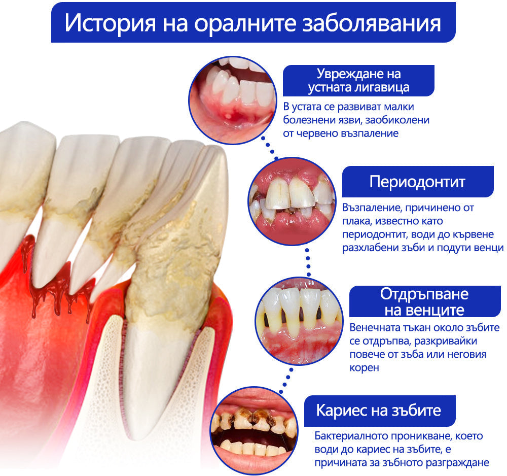 Furzero® 🦷 Focussmile Прах за третиране с пчелна отрова за перорално приложение 🌿