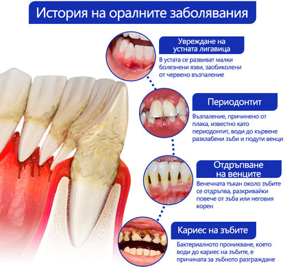 Furzero® 🦷 Focussmile Прах за третиране с пчелна отрова за перорално приложение 🌿