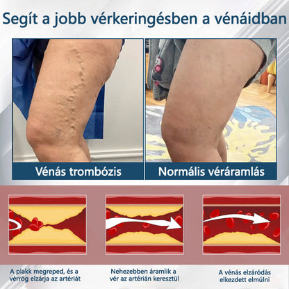 💧💧💧ATTDX® Növényi ödéma enyhítő krém nigellával