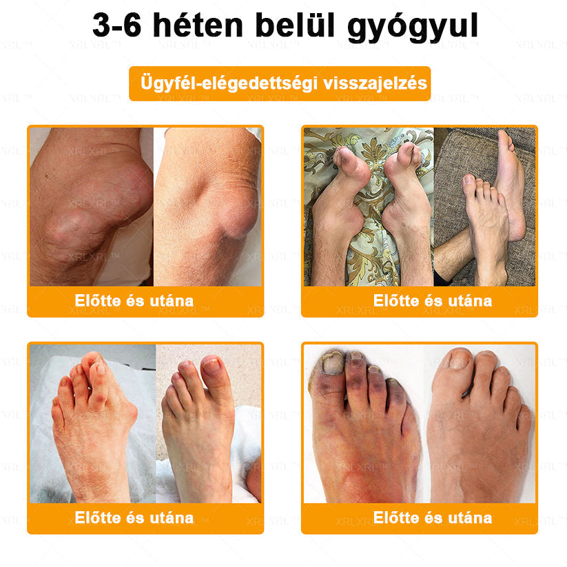 👍XRLXRL™ Méhméreg Fájdalomcsillapító Csontregeneráló Krém (Speziell für ältere Erwachsene & von der AAOS empfohlen)