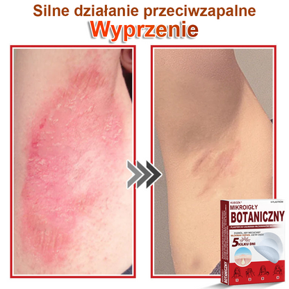 KUBOZN® Mikroigłowy botaniczny środek do usuwania narośli skórnych ✅✅wyprodukowano w Polsce