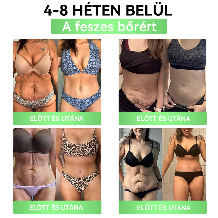 DOOEKA® GLP-1 20-az-1 Slim & Health Orális Oldat – Egyszerű napi használat, látványos eredmény 7 nap alatt, 100 milliárd aktív probiotikummal ✅ testsúlykezelés, szív-, cukorbetegség-, bél- és női egészség, feszes bőr, energia.