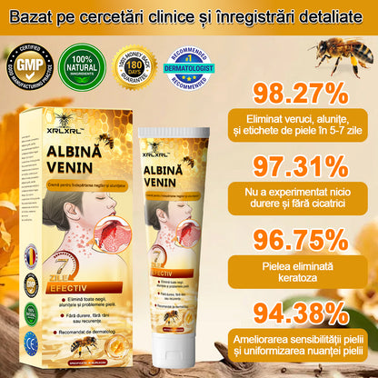 🎁 Doar 5 cutii rămase! Oferim un discount suplimentar de 50%! Menține-ți pielea sănătoasă. Repară acum, altfel va trebui să aștepți până anul viitor.